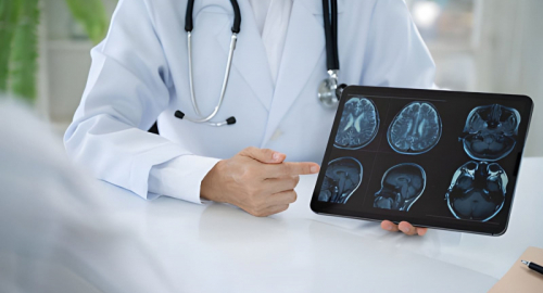Parkinson, primi risultati della terapia cellulare con staminali